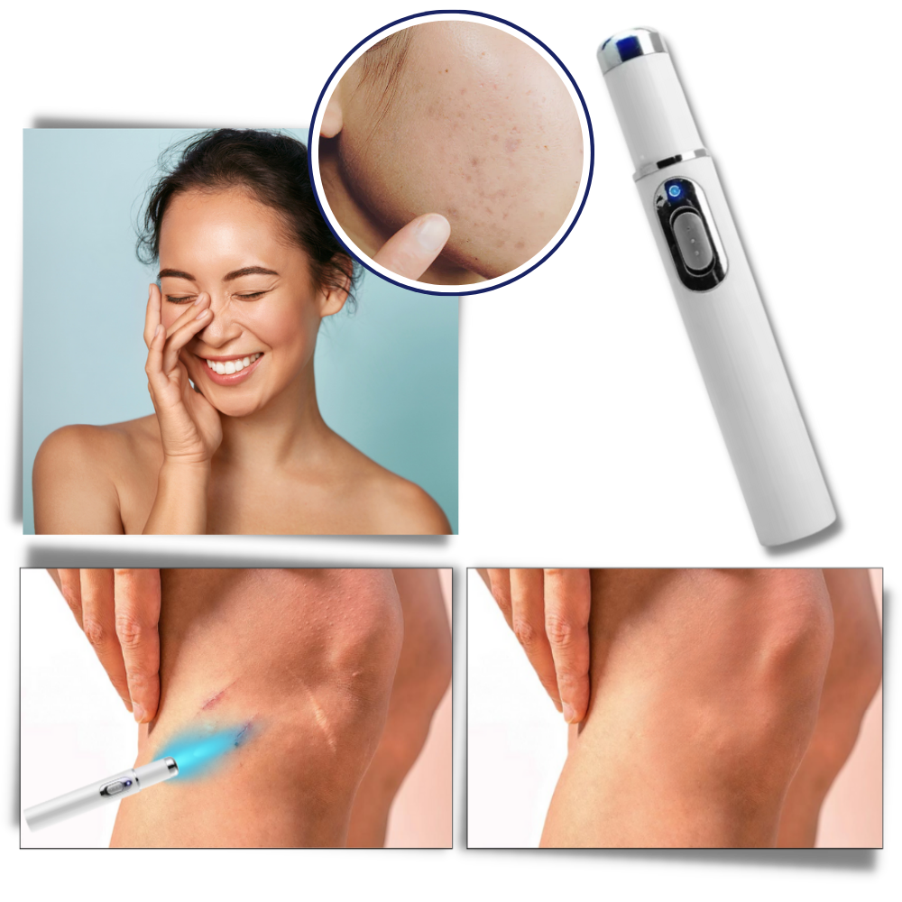 Appareil de Thérapie Laser Portable pour un Teint Éclatant 1