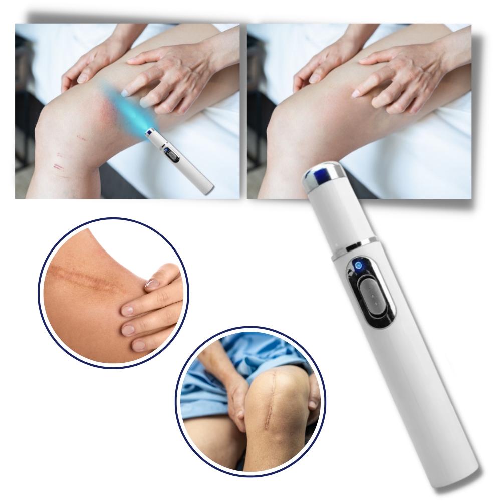 Appareil de Thérapie Laser Portable pour un Teint Éclatant 3