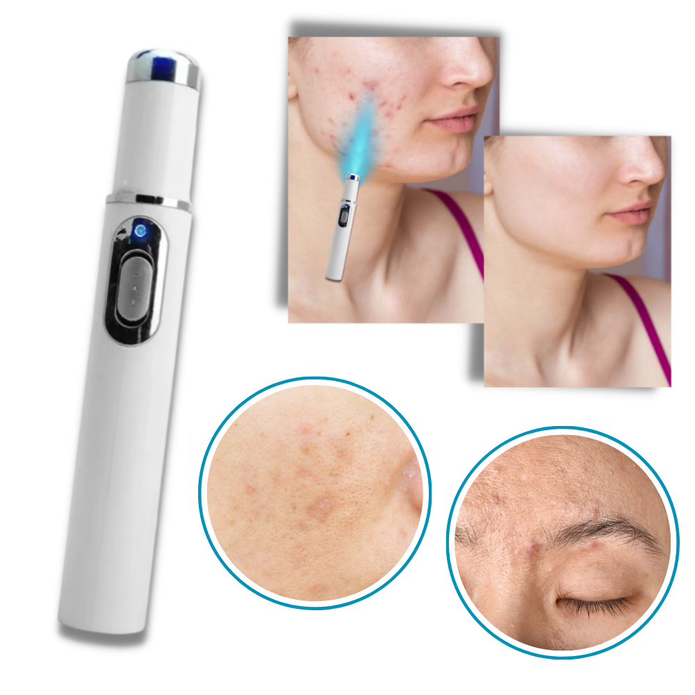 Appareil de Thérapie Laser Portable pour un Teint Éclatant 4