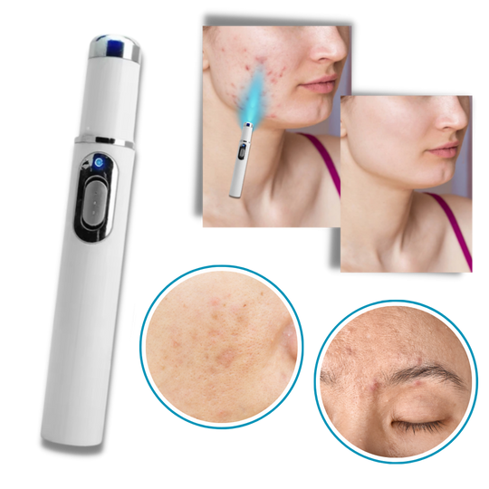 Appareil de Thérapie Laser Portable pour un Teint Éclatant 4