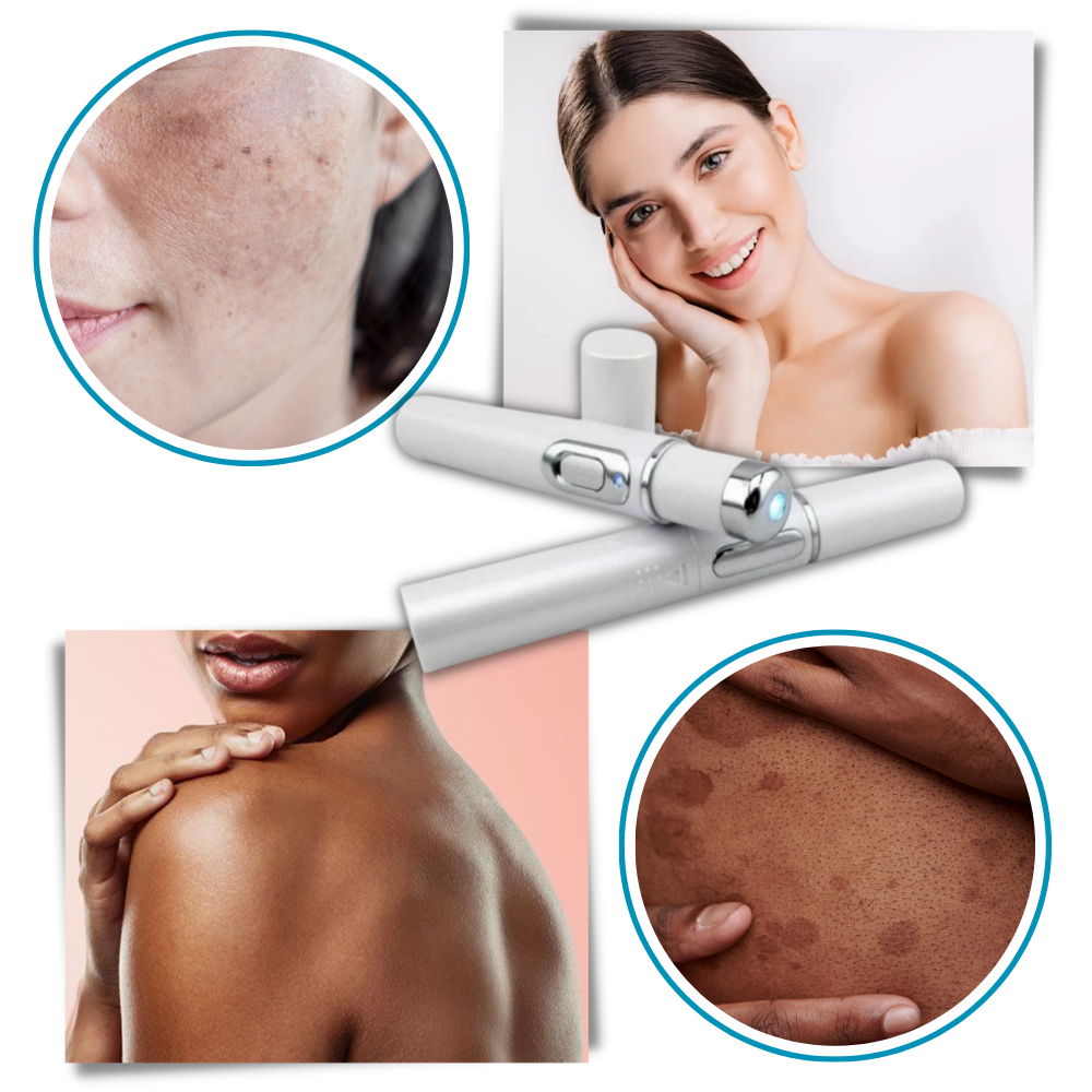 Appareil de Thérapie Laser Portable pour un Teint Éclatant 5
