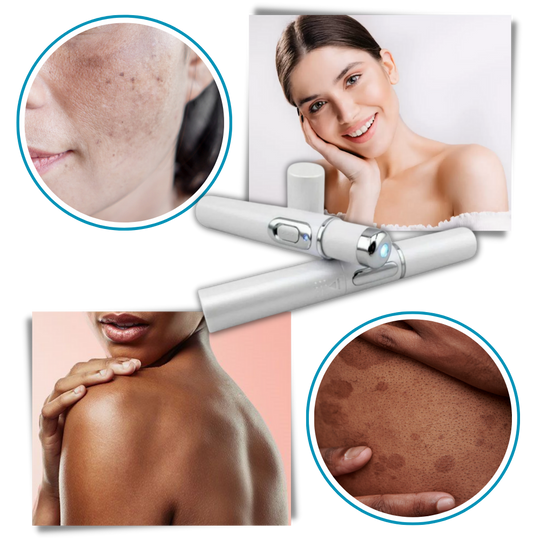 Appareil de Thérapie Laser Portable pour un Teint Éclatant 5