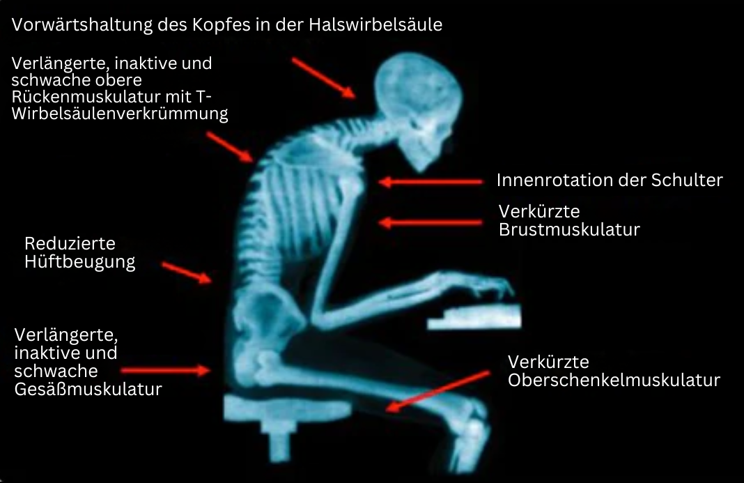 Bandage Postural Innovant pour un Maintien Optimal 3