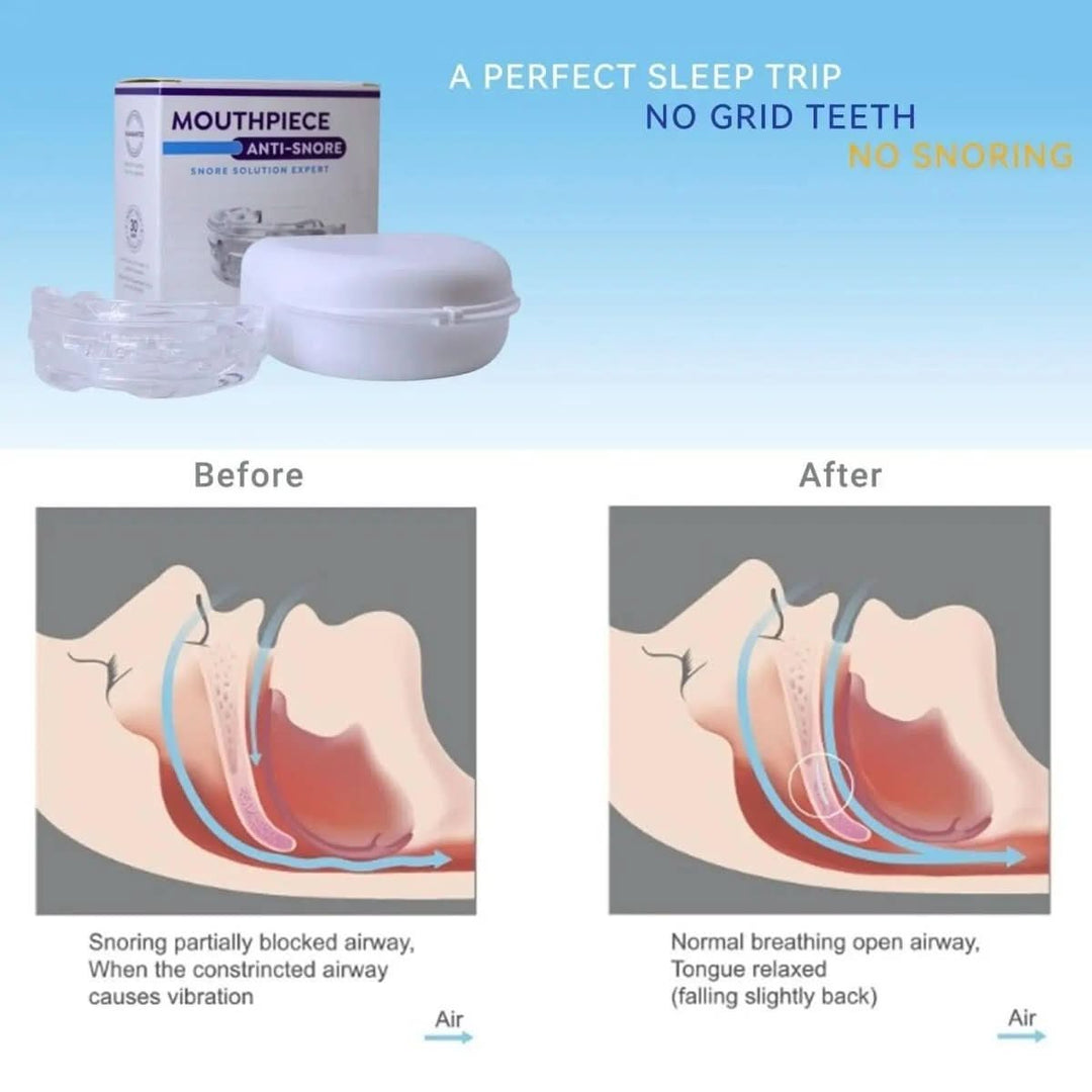 Embout Buccal Anti-Ronflement Personnalisable 2