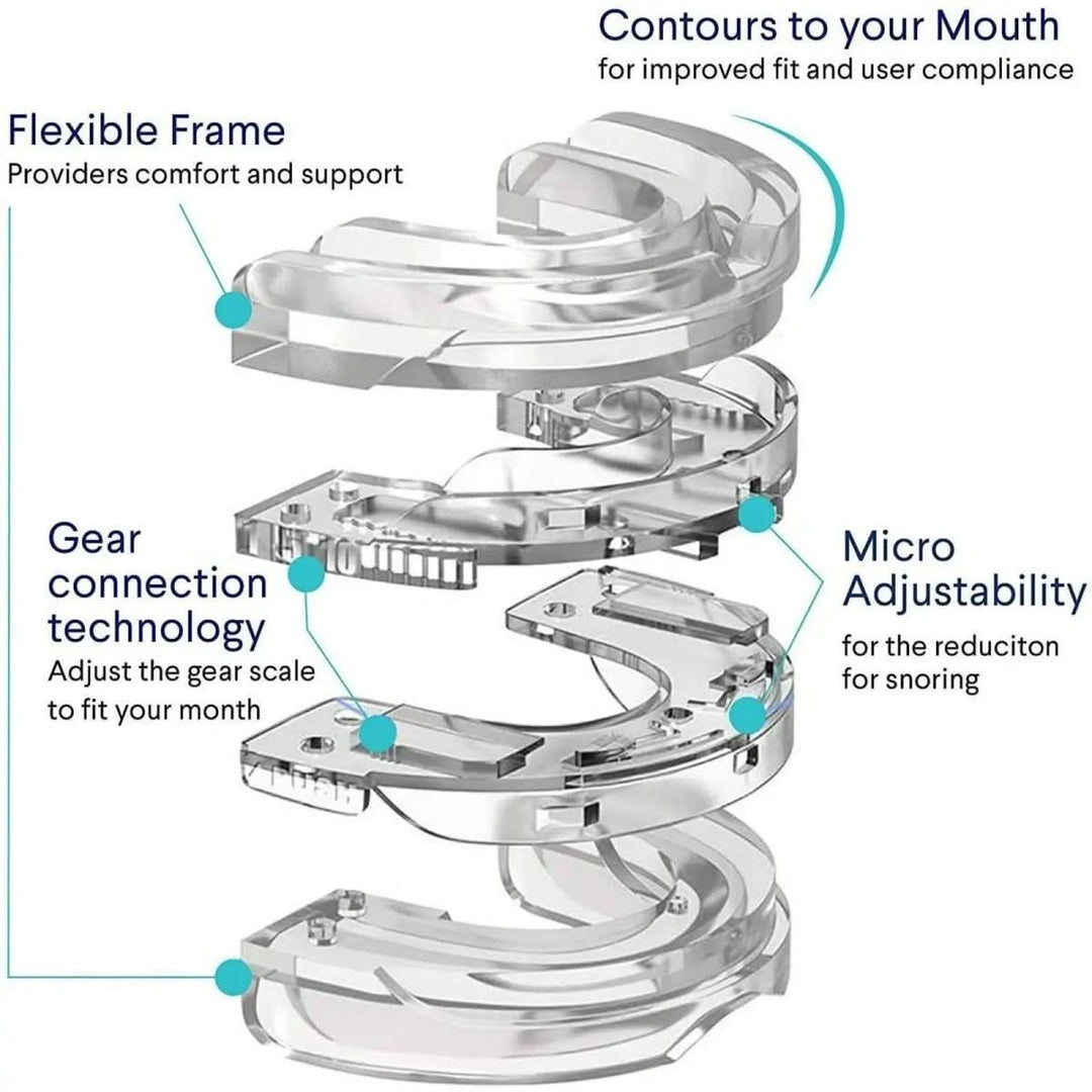 Embout Buccal Anti-Ronflement Personnalisable 4