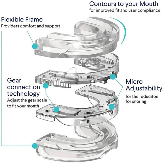 Embout Buccal Anti-Ronflement Personnalisable 4