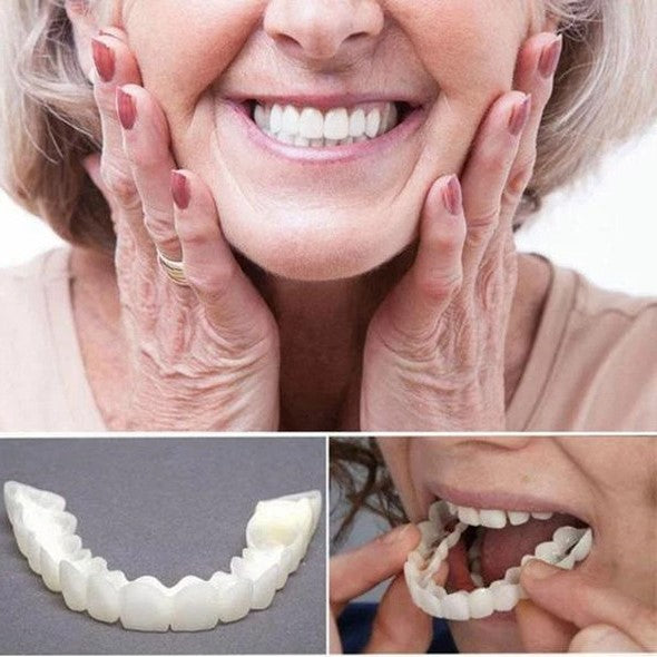 Facettes Dentaires Amovibles pour Un Sourire Parfait 1