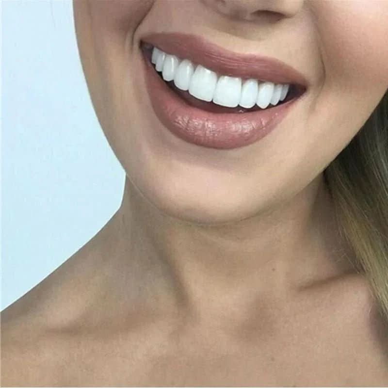 Facettes Dentaires Réutilisables pour un Sourire Éclatant 2