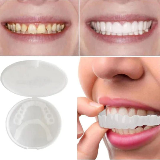 Facettes Dentaires Réutilisables pour un Sourire Éclatant 3