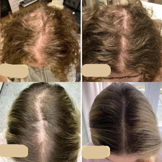 Huile Végétalienne pour Cheveux Nourrissante 4