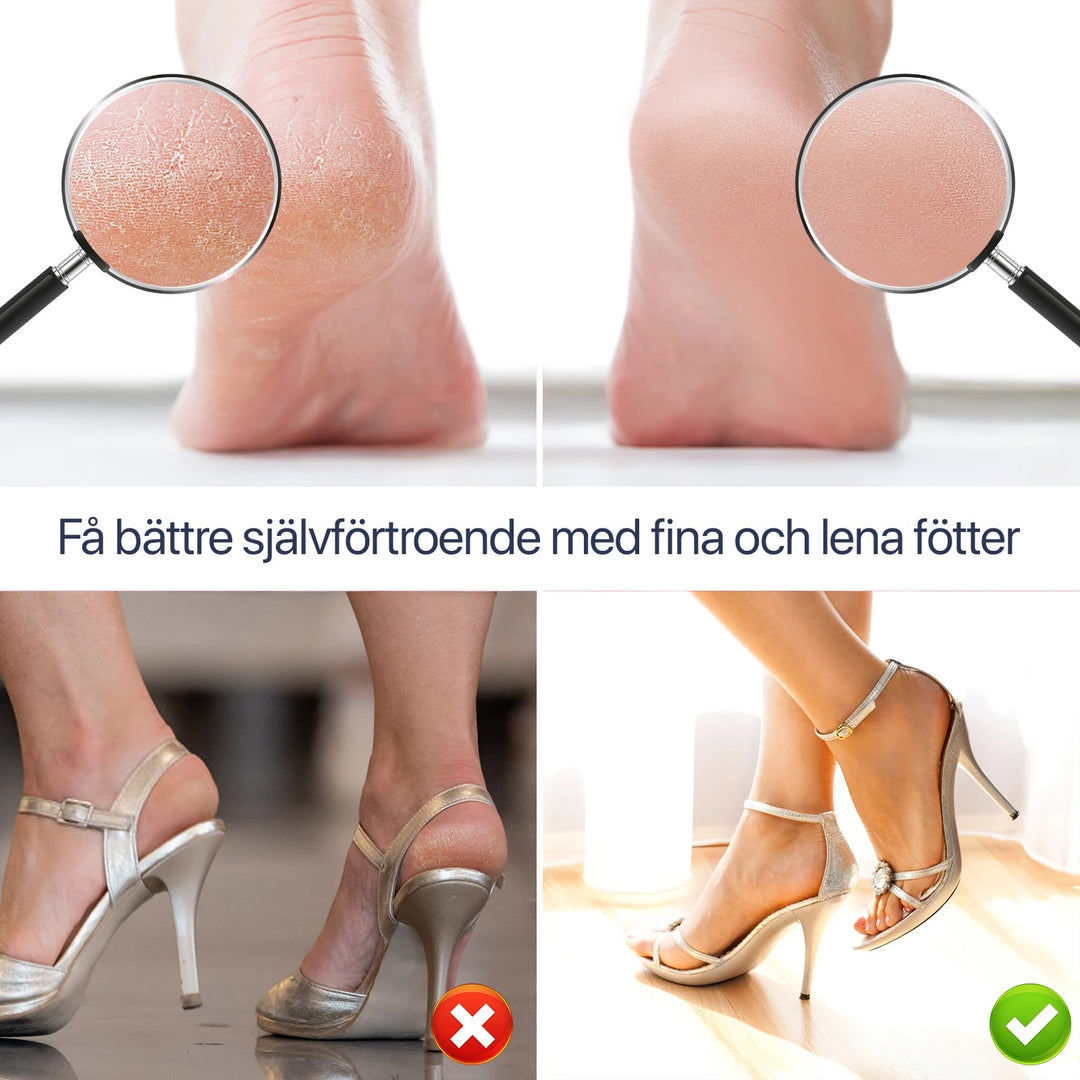 Lime À Pieds Électrique Avec Tête Rotative 360° Pour Soin Rapide 1