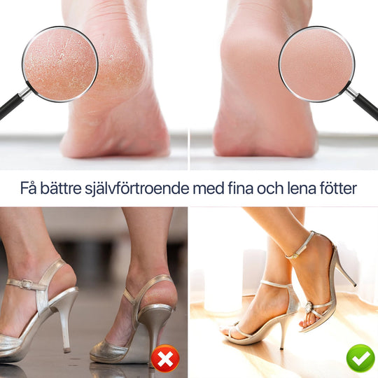 Lime À Pieds Électrique Avec Tête Rotative 360° Pour Soin Rapide 1