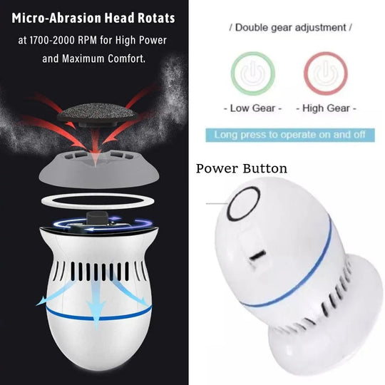 Ponceuse Électrique Pour Pieds Avec Aspirateur Intégré et Têtes Interchangeables 1