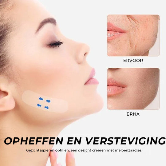 Ruban Invisible de Lifting pour le Visage Discret 3